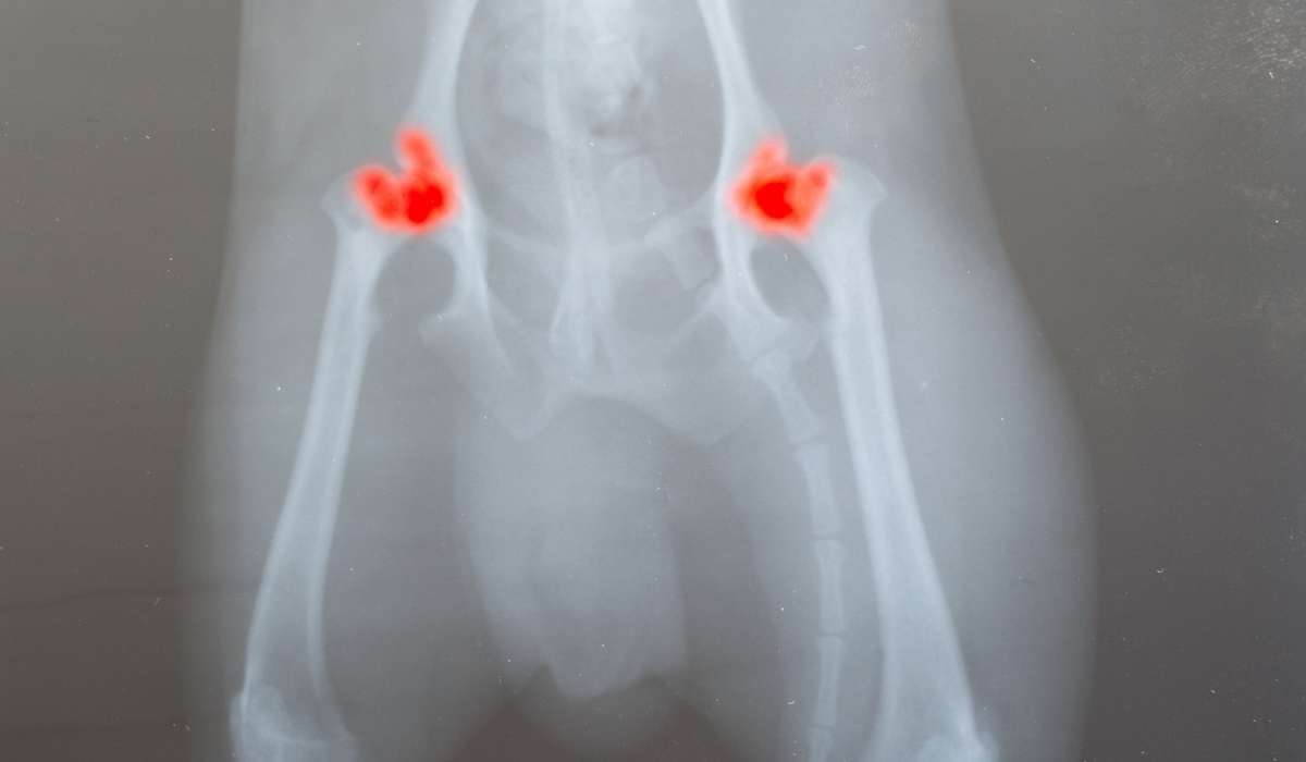 Síntomas de la displasia de cadera