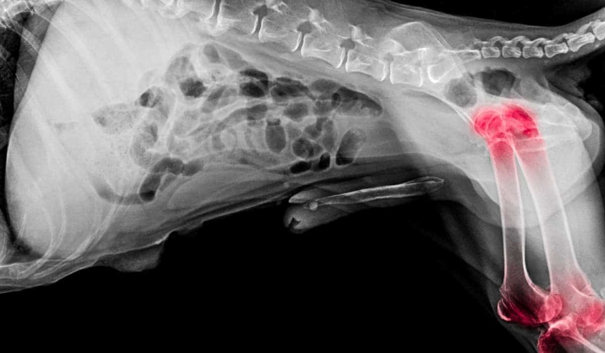 Tratamientos de la displasia de cadera